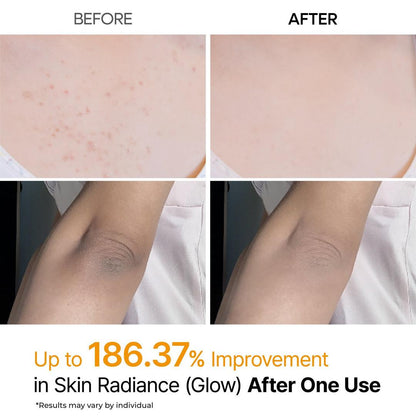 Kojic Acid & Turmeric Body Exfoliator Spray