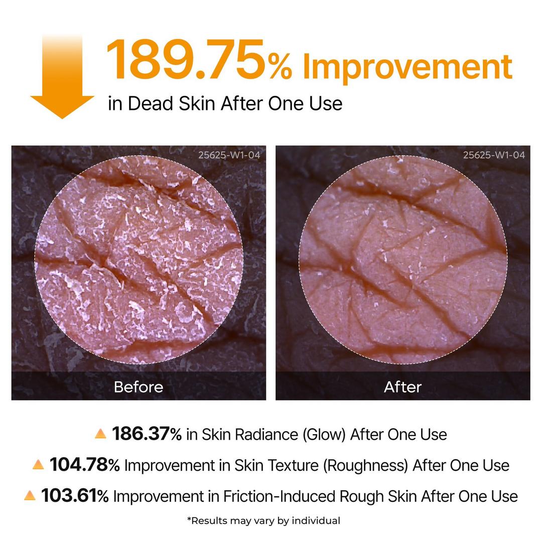 Kojic Acid & Turmeric Body Exfoliator Spray