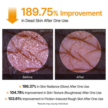 Kojic Acid & Turmeric Body Exfoliator Spray